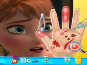 Play Anna frozen Hand Doctor: Fun Games for Girls Onlin